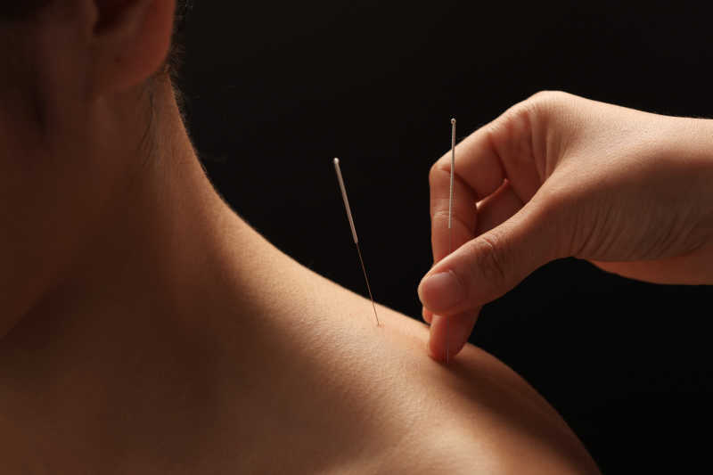 Cervical spine neck TCM acupuncture NY
