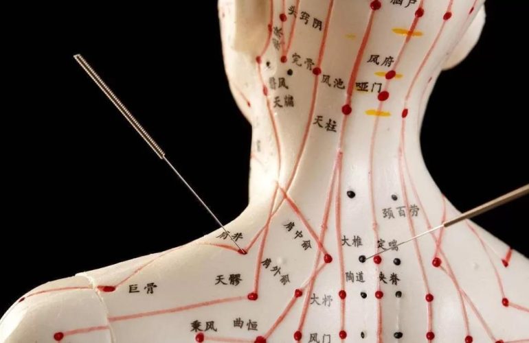 Chronic pain management TCM acupuncture Flushing NY clinic