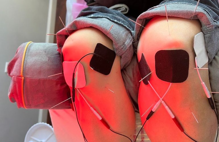 Physical therapy rehabilitation Flushing NY